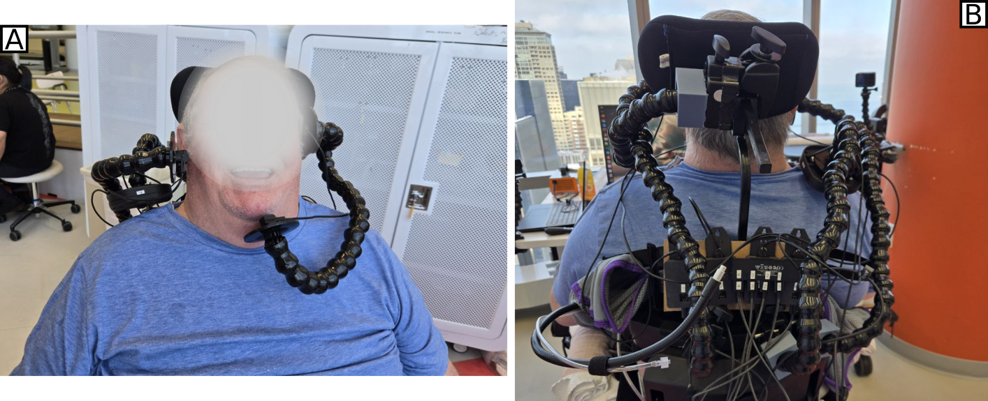 Zero-Force Optical Sensor Interface and Fitting Protocol for Assistive Technology Control